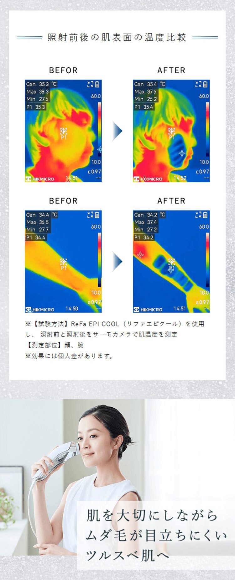 ReFa リファ エピ クール  光美容器 脱毛器 ムダ毛ケア 美肌ケア 冷却機能 全身 顔 安全 安心 パワー 効果 痛くない ReFa リファ  