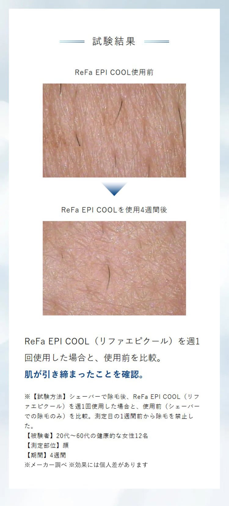 ReFa リファ エピ クール  光美容器 脱毛器 ムダ毛ケア 美肌ケア 冷却機能 全身 顔 安全 安心 パワー 効果 痛くない ReFa リファ  