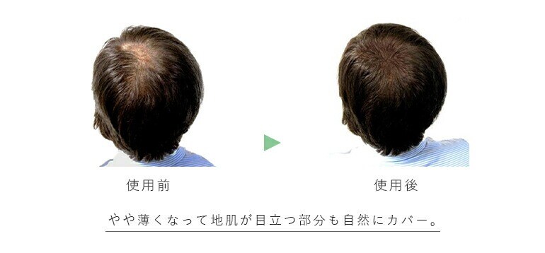 薄毛使用前・使用後