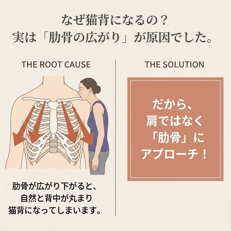 なぜ猫背になるの？/実は肋骨の広がりが原因