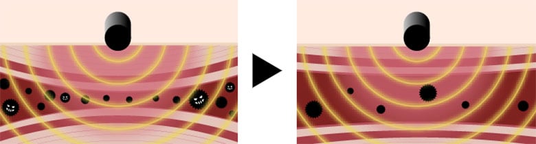 オンフォー 磁気 ネックレス