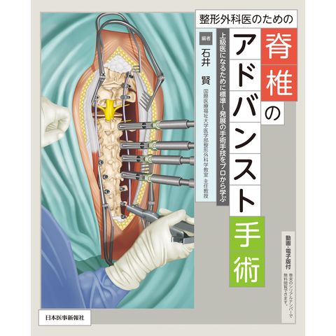 dショッピング |整形外科医のための脊椎のアドバンスト手術 上級医に