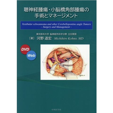 dショッピング |聴神経腫瘍・小脳橋角部腫瘍の手術とマネージメント