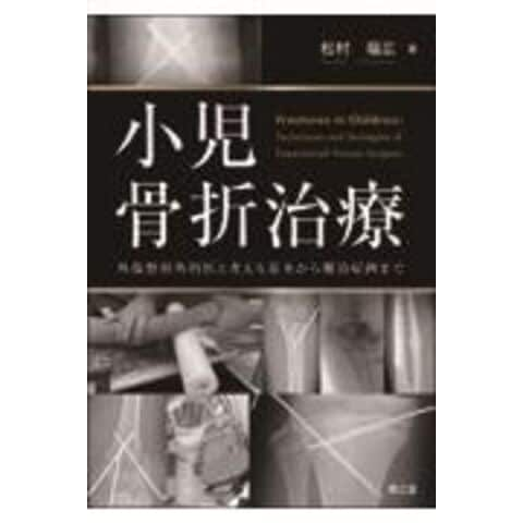 dショッピング |小児骨折治療 外傷整形外科医と考える基本から難治症例まで /松村福広 | カテゴリ：の販売できる商品 | HonyaClub.com  (0969784524225248)|ドコモの通販サイト