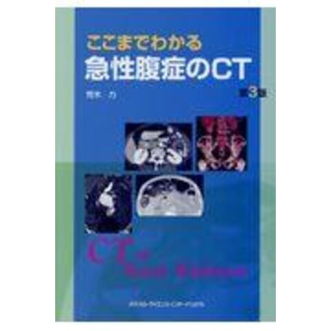 dショッピング |ここまでわかる急性腹症のＣＴ 第３版 /荒木力