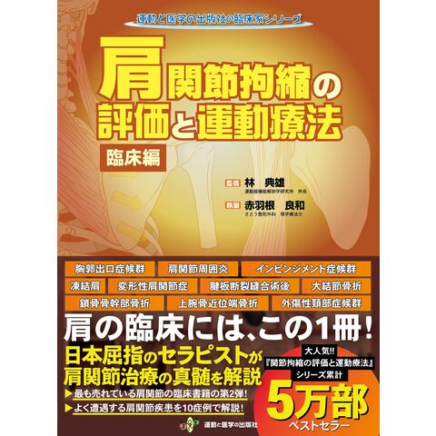 dショッピング |肩関節拘縮の評価と運動療法 臨床編 /林典雄 赤羽根