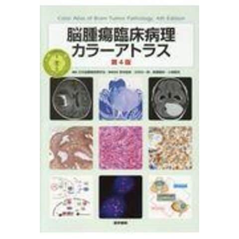 dショッピング |脳腫瘍臨床病理カラーアトラス 第４版 /日本脳腫瘍病理学会 | カテゴリ：の販売できる商品 | HonyaClub.com  (0969784260030472)|ドコモの通販サイト